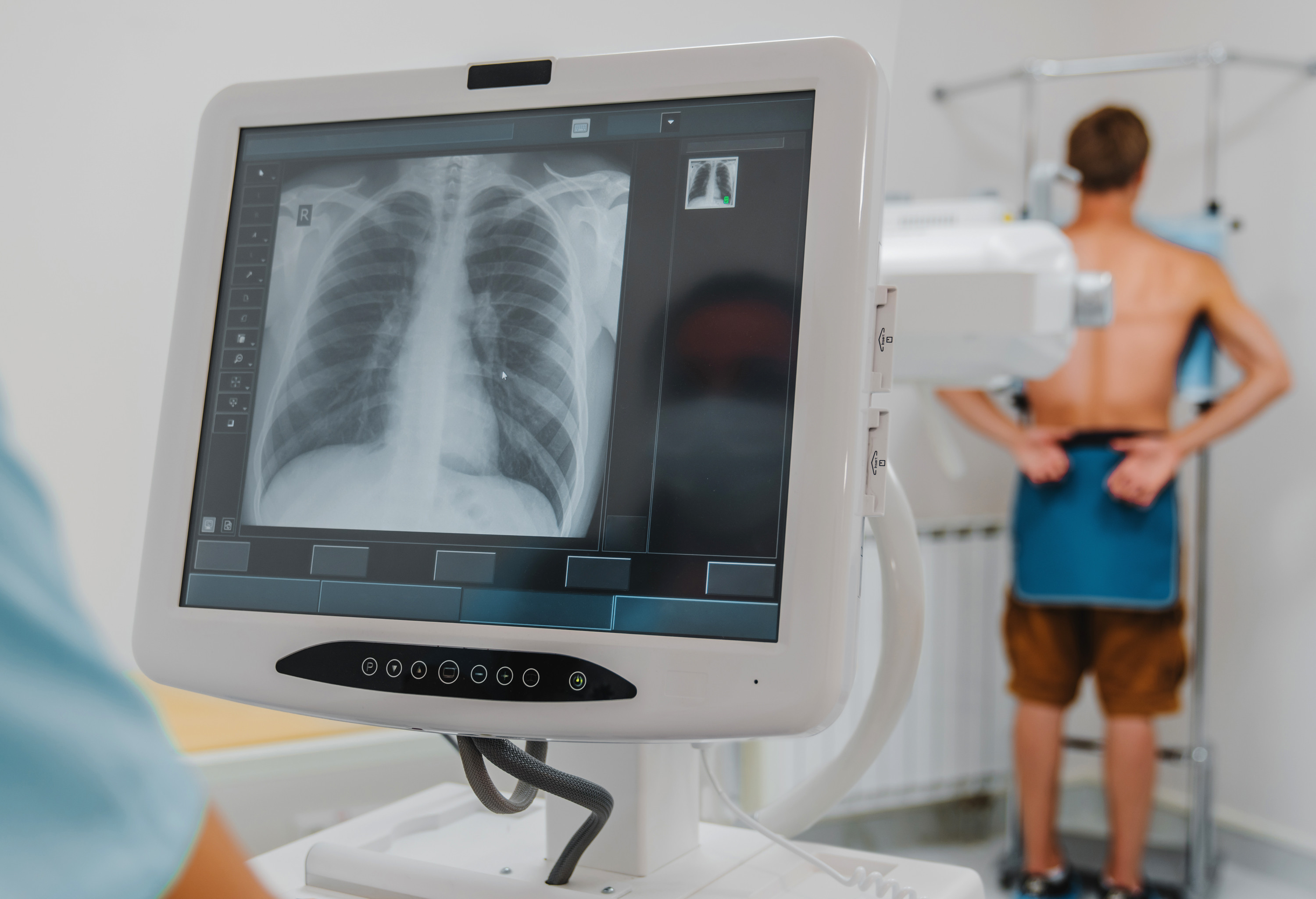 Patient having chest X-ray
