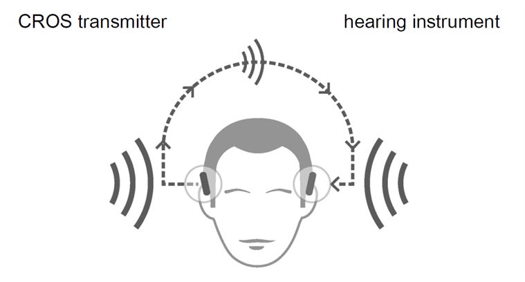 Diagram to demonstrate sound being transmitted from one ear to the other