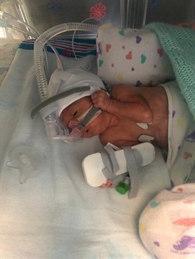 Enzo Alexander Welch in hospital - image shows premature baby in an incubator with a breathing mask on his face