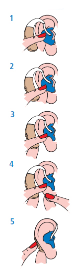 Inserting your hearing aid with ear moulds