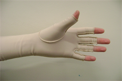 Hand Therapy  Compression Garment