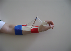 Hand Therapy Thermoplastic Splinting