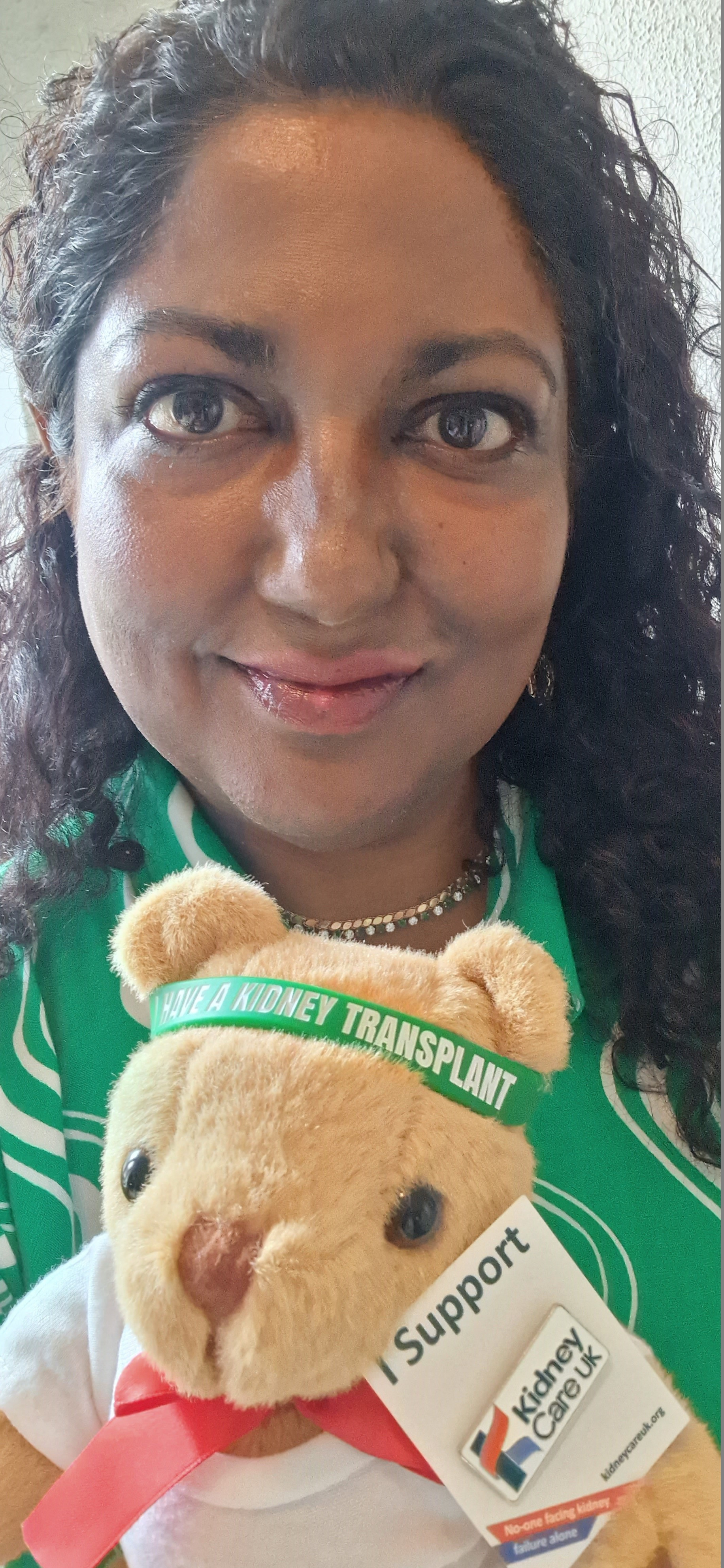 Anandani Peries, holding a teddy bear with a kidney transplant bracelet on its head
