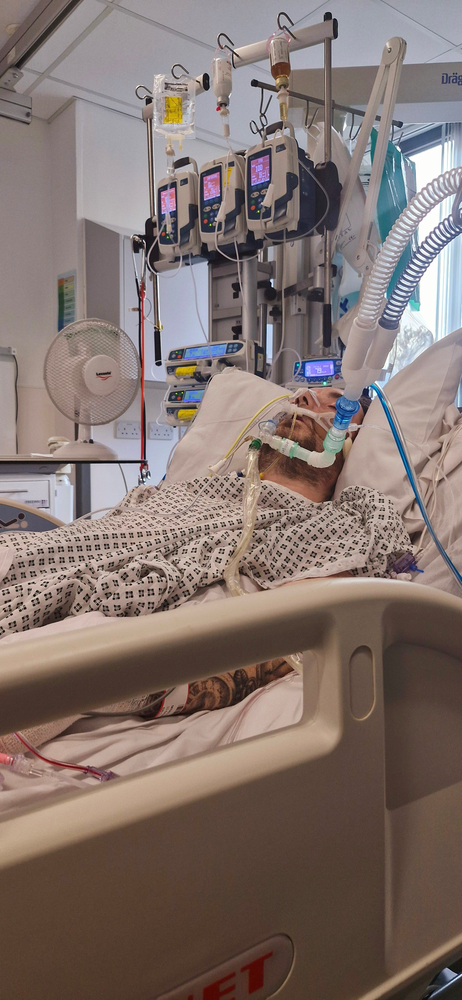 Craig in critical care. He is in a hospital bed with tubes connected to him